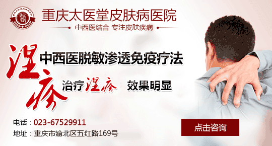 温州华医堂治疗湿疹技术