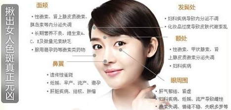 中年女性长黄褐斑的烦恼!