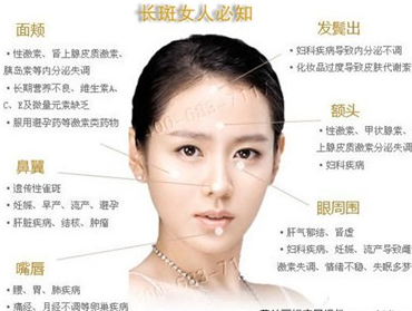 自生的因素,成就了雀斑